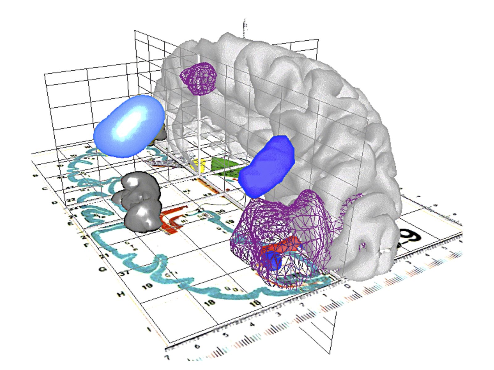 The Brain X – Transforming Knowledge to Innovation